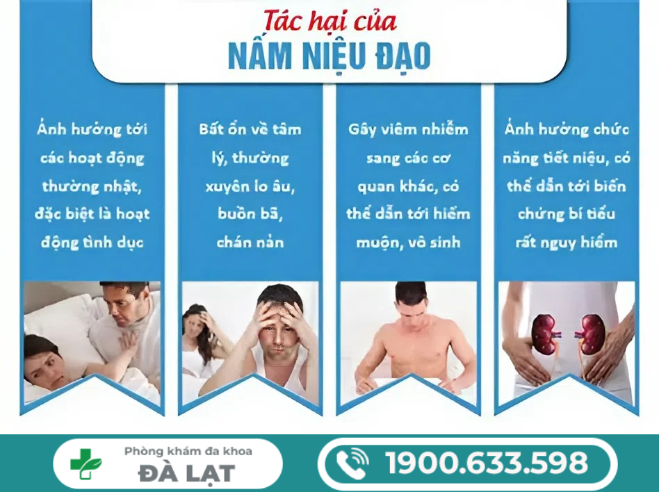 Hình ảnh minh họa